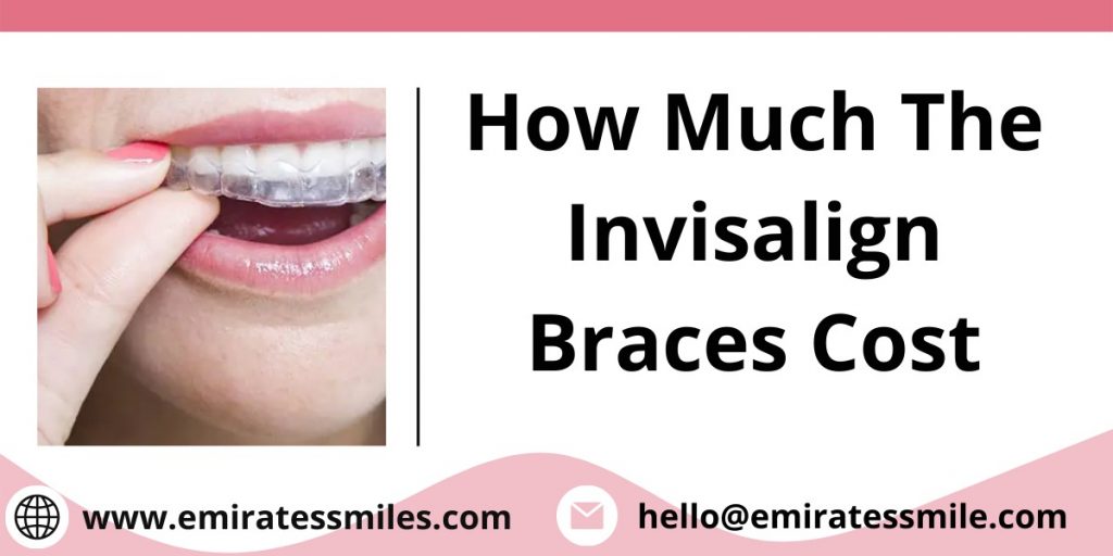 How Much The Invisalign Braces Cost